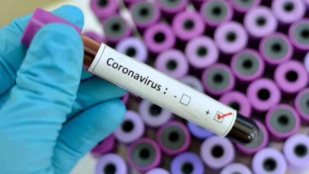 Осінні спалахи COVID-19: лікарка розповіла, хто потребує вакцинації