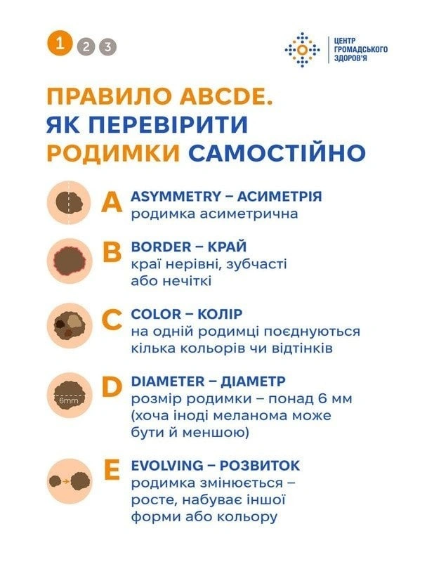 Прихована агресія меланоми: як розпізнати смертельну небезпеку на ранній стадії